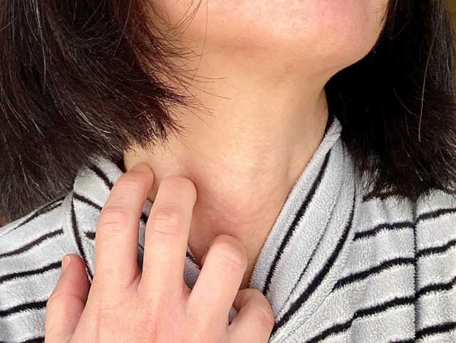 スギ花粉皮膚炎・・・遅発型接触アレルギー