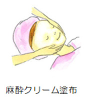 麻酔クリーム塗布
