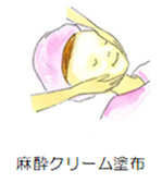 麻酔クリーム塗布
