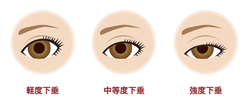 イメージ2