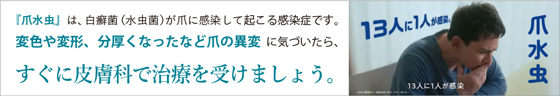 『爪水虫』は、白癬菌（水虫菌）が爪に感染して起こる感染症です。変色や変形、分厚くなったなど爪の異変に気づいたら、すぐに皮膚科で治療を受けましょう。