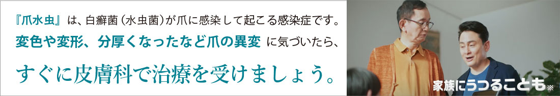 『爪水虫』は、白癬菌（水虫菌）が爪に感染して起こる感染症です。変色や変形、分厚くなったなど爪の異変に気づいたら、すぐに皮膚科で治療を受けましょう。